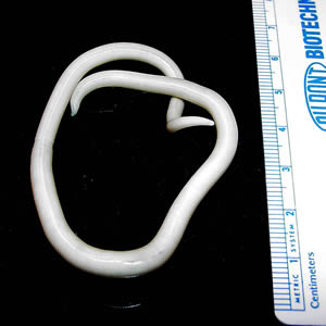 Adult Ascaris lumbricoides