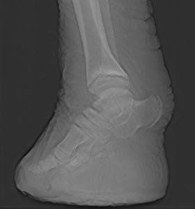 X-ray image of an elephant's foot. Picture from "What's in John's freezer?"